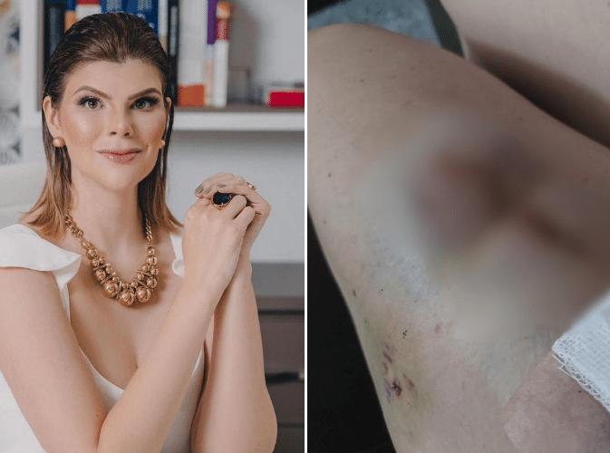 Médica do Paraná se torna ré por dar falsos diagnósticos de câncer de pele e recomendar cirurgias desnecessárias