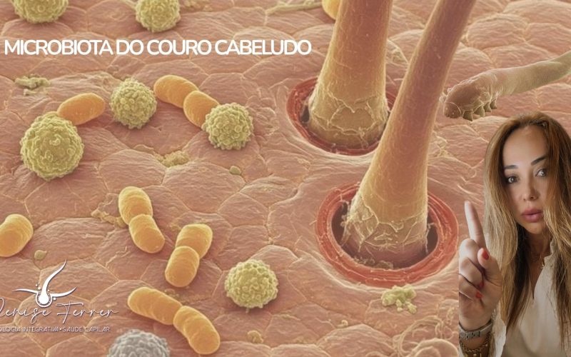 Como recuperar a microbiota do couro cabeludo